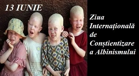 13 iunie - Ziua mondială de conştientizare a albinismului